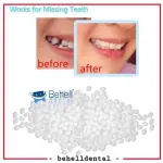 GIGI PALSU SEMENTARA 200 BUTIR / PENAMBAL GIGI PATAH RENGGANG TEMPORARY TOOTH TEMPTOOTH GINGSUL PATAH