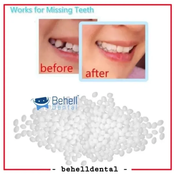 GIGI PALSU SEMENTARA 200 BUTIR / PENAMBAL GIGI PATAH RENGGANG TEMPORARY TOOTH TEMPTOOTH GINGSUL PATAH