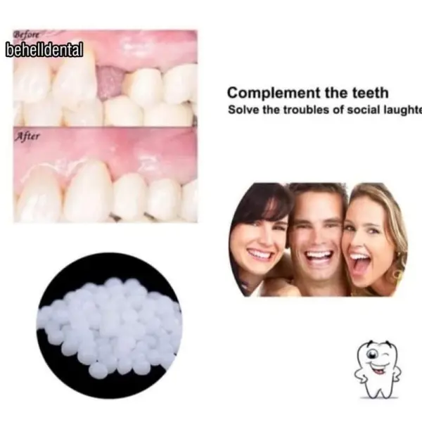 GIGI PALSU SEMENTARA 200 BUTIR / PENAMBAL GIGI PATAH RENGGANG TEMPORARY TOOTH TEMPTOOTH GINGSUL PATAH